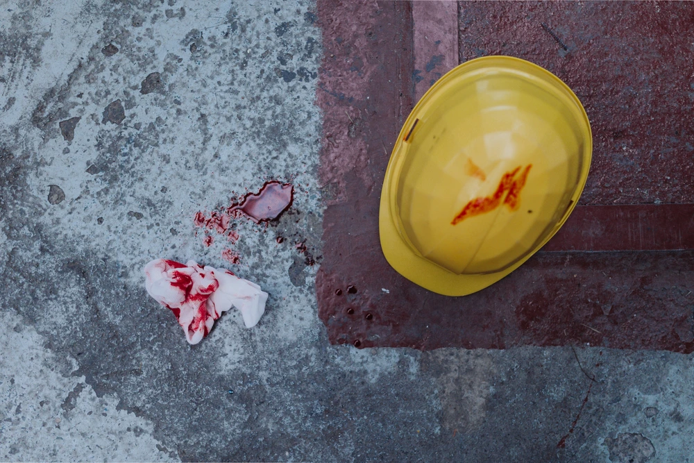 Helmet And Tissue With Blood Stains And Blood On T 2026 03 10 03 09 43 Utc 1